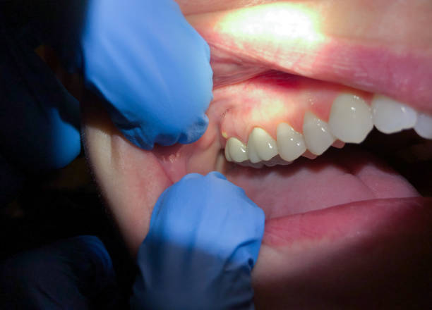 Best Weekend Emergency Dentist in Lake Mohegan, NY